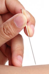 Does Acupuncture Work?