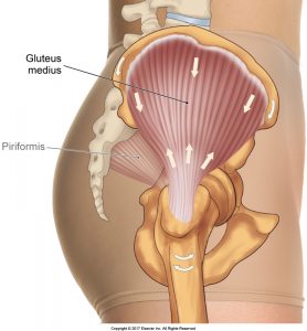 Hip Bursitis FIGURE-2-Gluteus Medius
